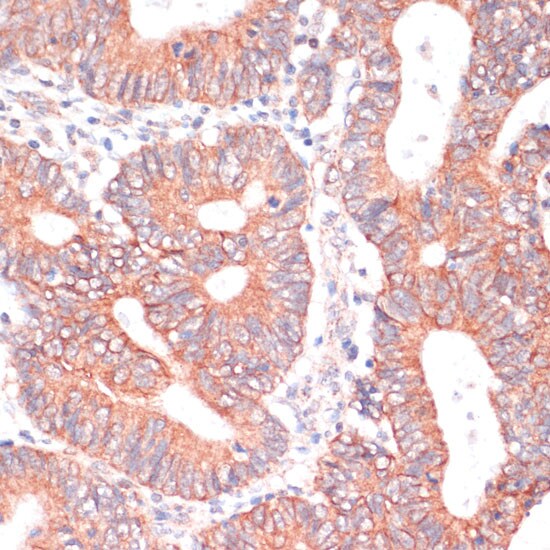TIAM1 Antibody