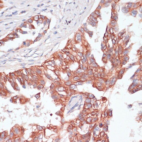 TIAM1 Antibody