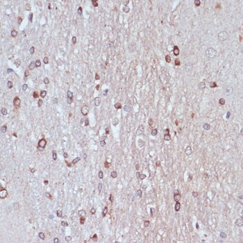 TPD52 Antibody