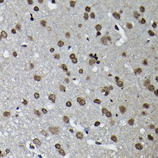 CCNK Antibody