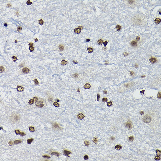 CCNK Antibody