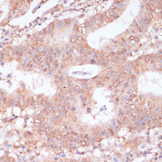 BYSL Antibody