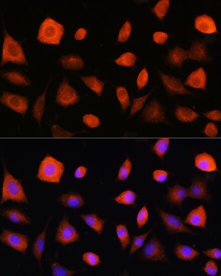 eIF2B epsilon Antibody