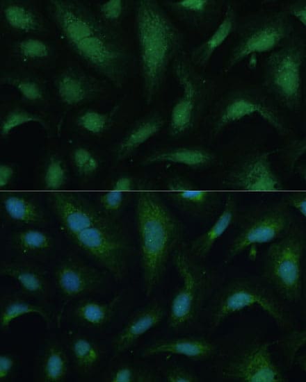 KIF14 Antibody