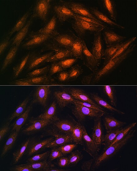 DUSP14 Antibody