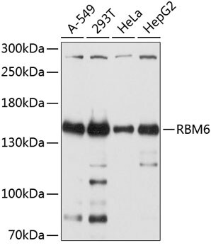 RBM6 Antibody