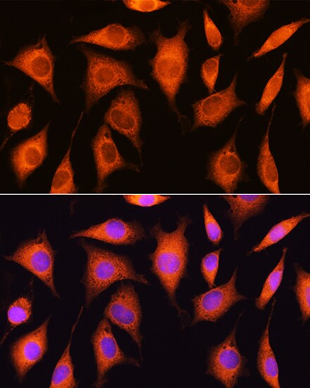 RRP4 Antibody
