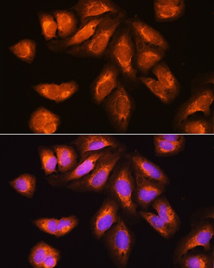 RRP4 Antibody