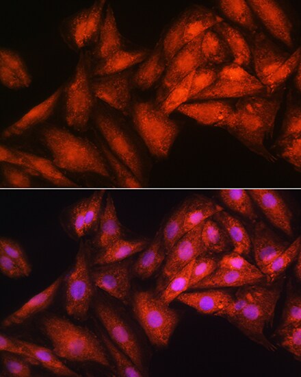 RRP4 Antibody
