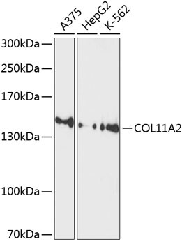 Collagen XI alpha 2 Antibody