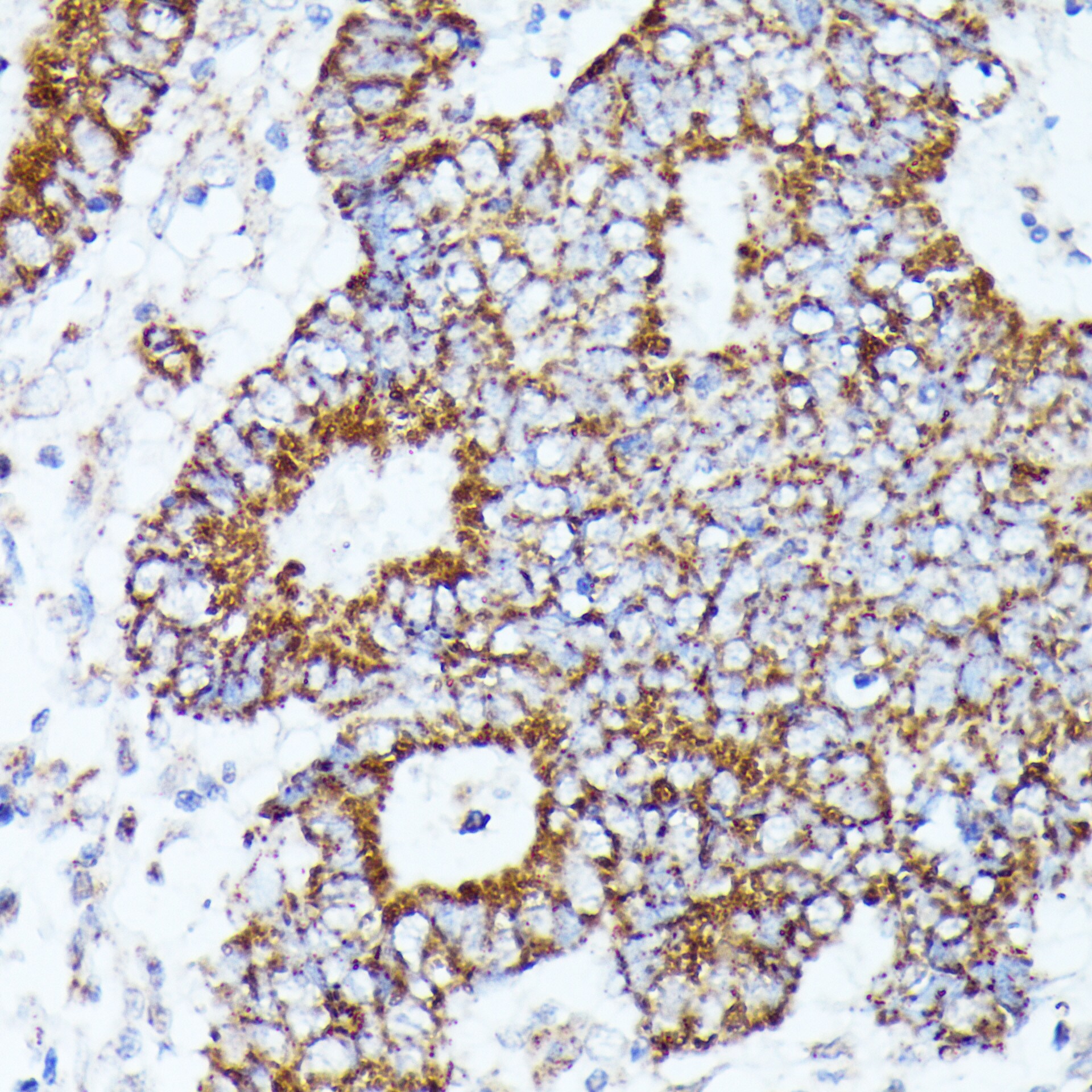AKR1C2 Antibody