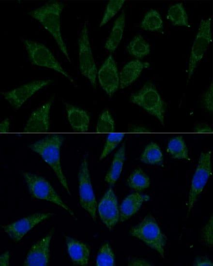 AKR1C2 Antibody