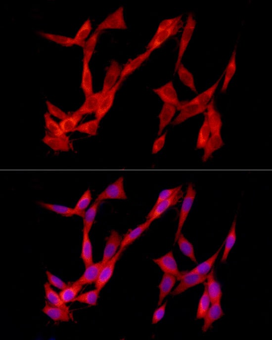 TREM2 Antibody