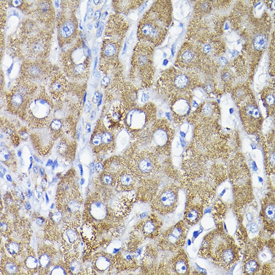 TST Antibody
