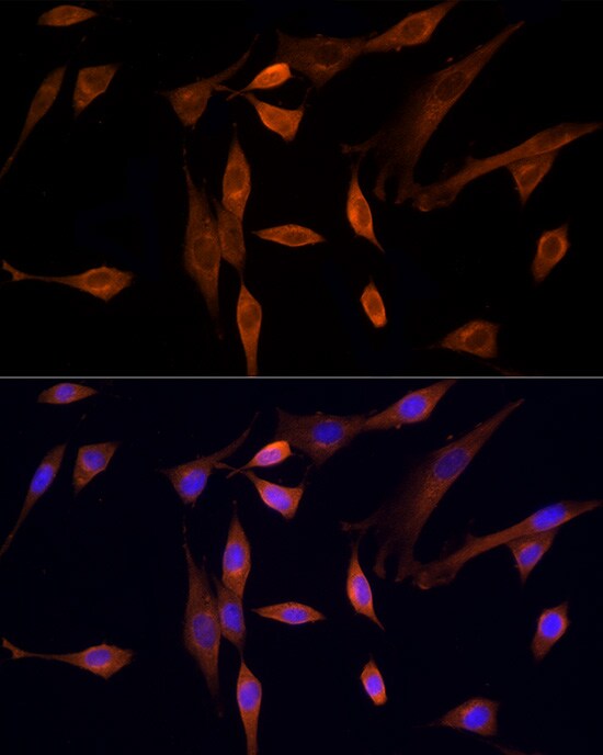 MST3 Antibody