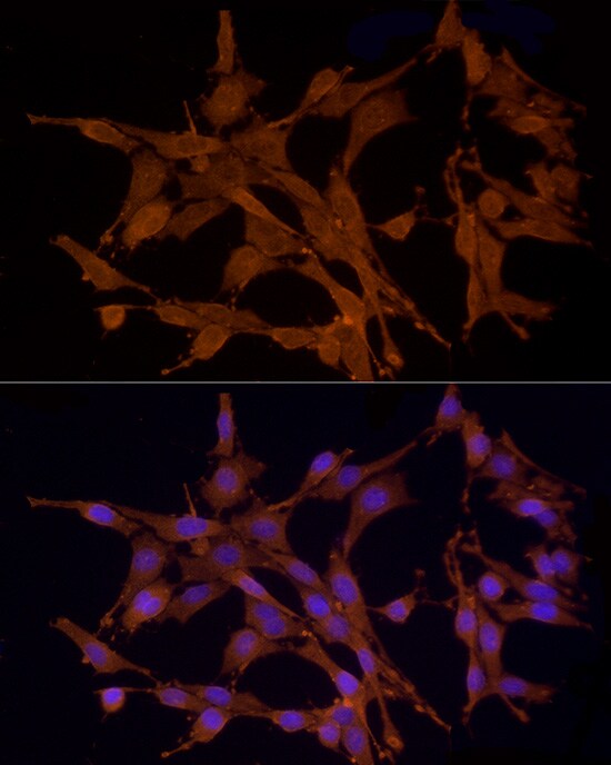 MST3 Antibody