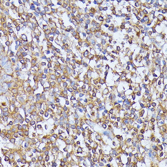 MST3 Antibody