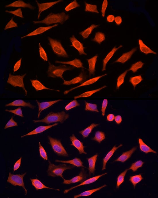 MST3 Antibody