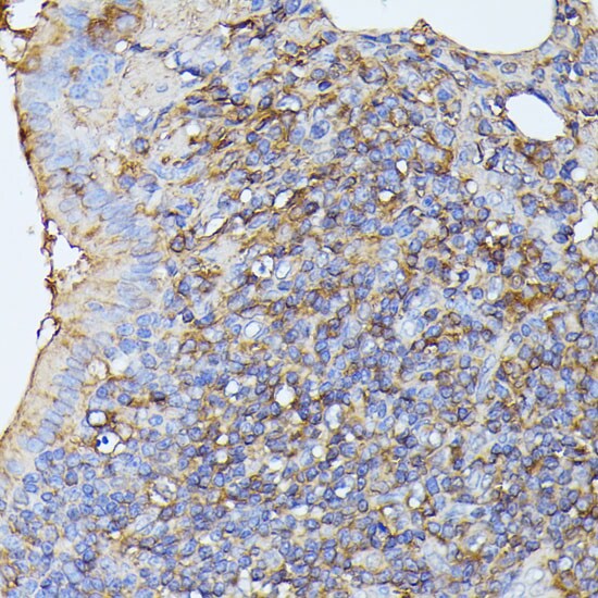 MST3 Antibody