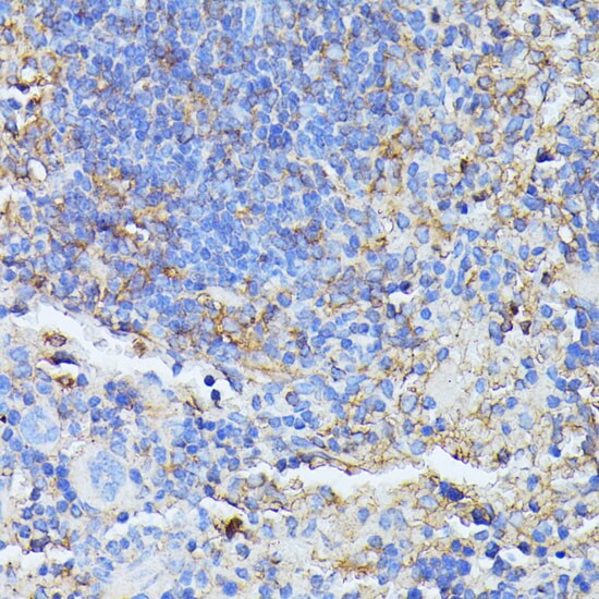MST3 Antibody