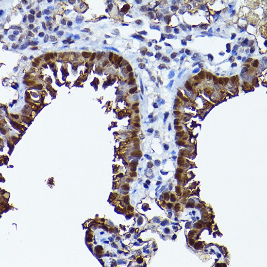 SEC14L2 Antibody
