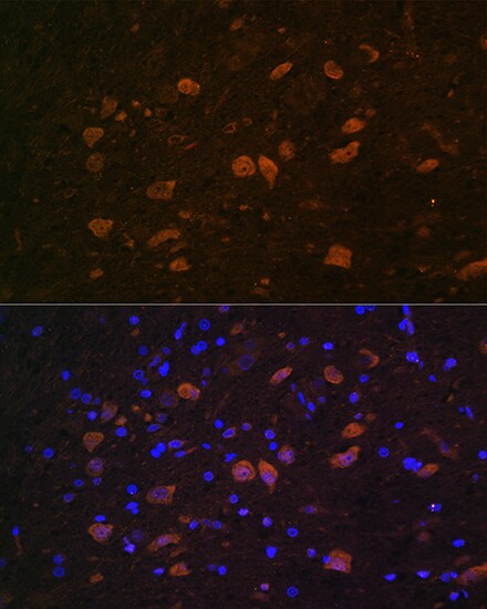 ELAVL4 Antibody