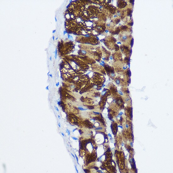 Protein Phosphatase 1 beta Antibody