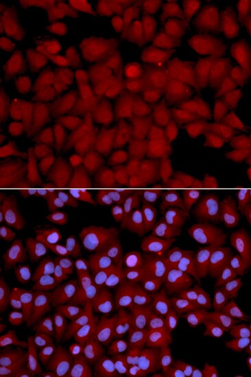 Protein Phosphatase 1 beta Antibody