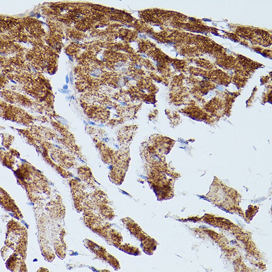 SERCA2 ATPase Antibody