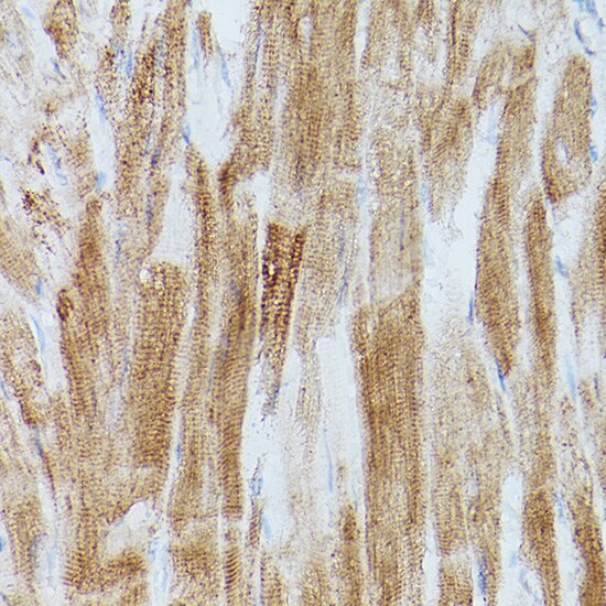 SERCA2 ATPase Antibody