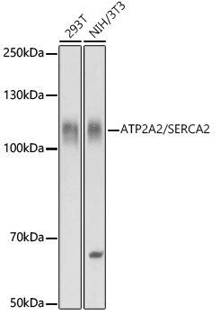 SERCA2 ATPase Antibody