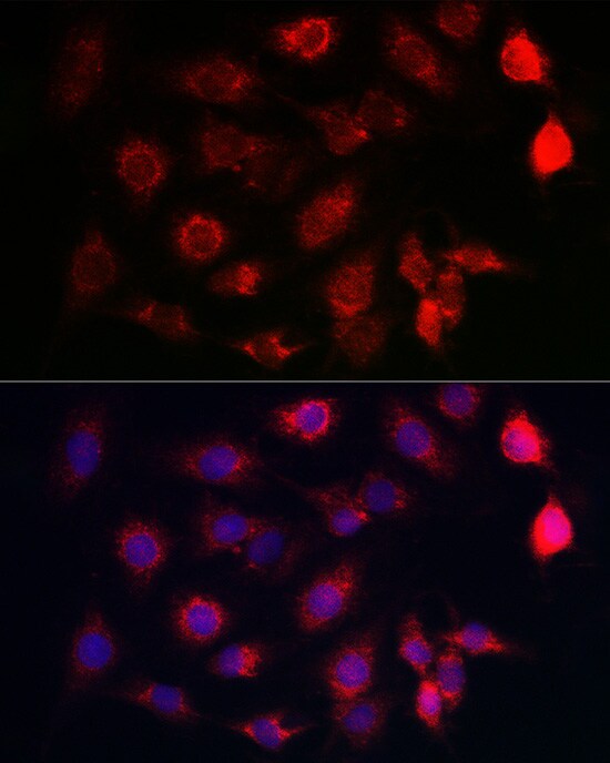 SERCA2 ATPase Antibody