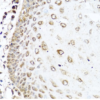 RAC2 Antibody