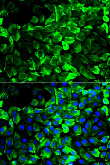 Tropomyosin-1 Antibody