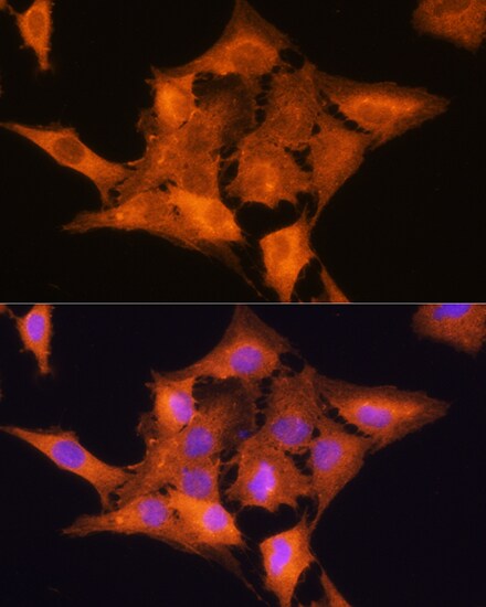 Aldolase C Antibody
