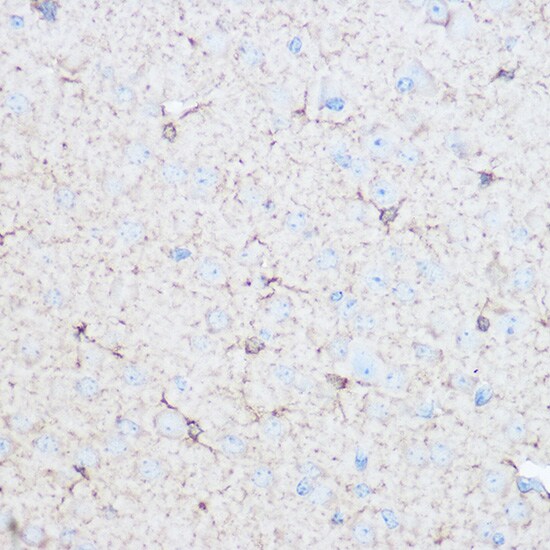 Aldolase C Antibody