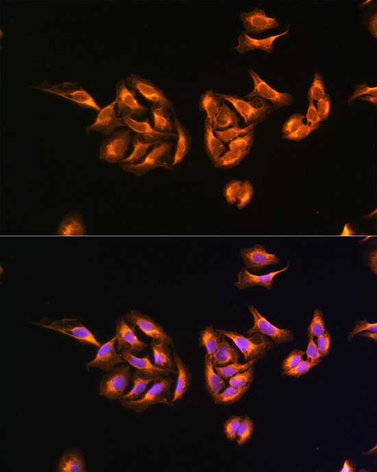 MRPS27 Antibody