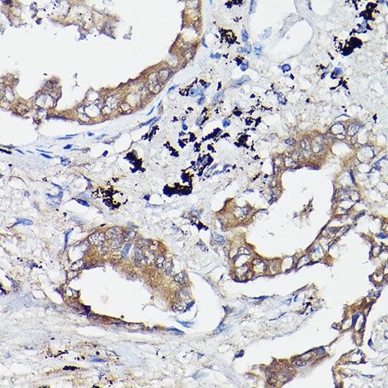 GTPBP9 Antibody