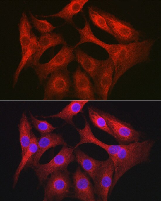 GTPBP9 Antibody