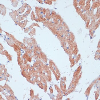 ACSL3 Antibody