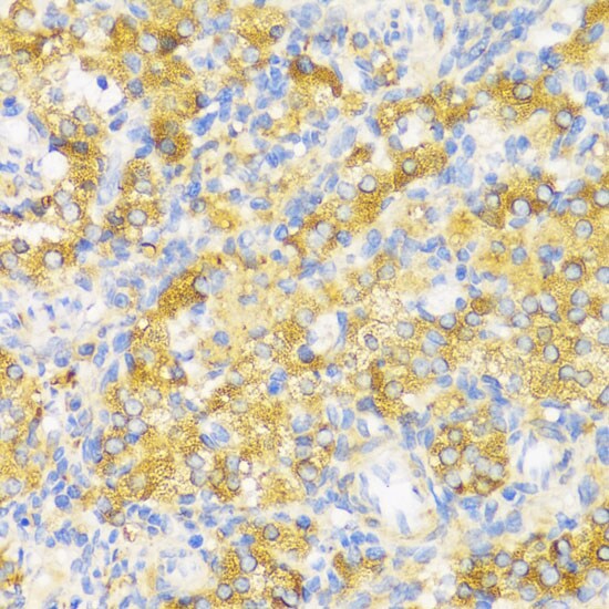 HLA DPB1 Antibody