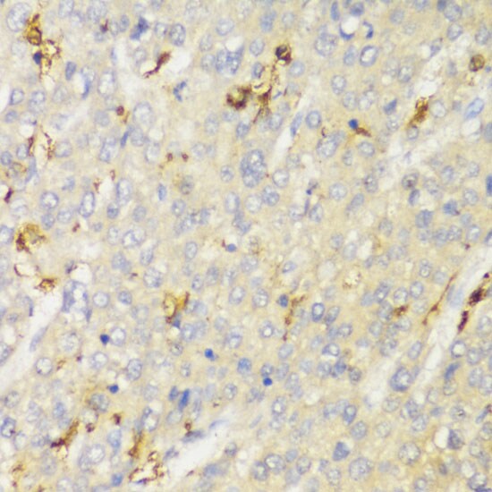 HLA DPB1 Antibody