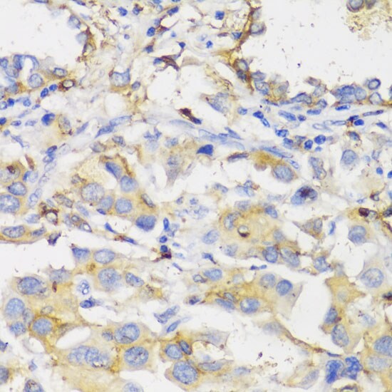HLA DPB1 Antibody