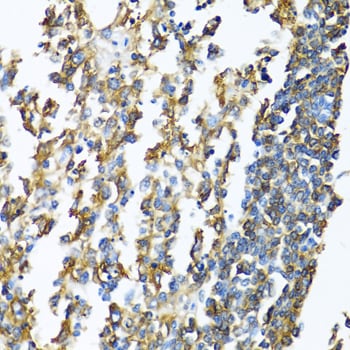 HLA DPB1 Antibody