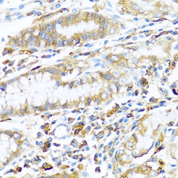 HLA DPB1 Antibody