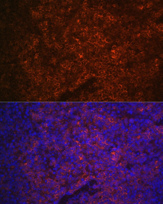 P2X5/P2RX5 Antibody