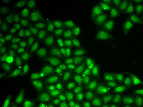 FEN-1 Antibody