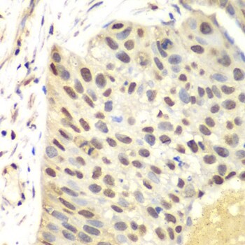FEN-1 Antibody