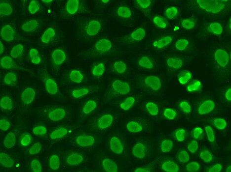FEN-1 Antibody