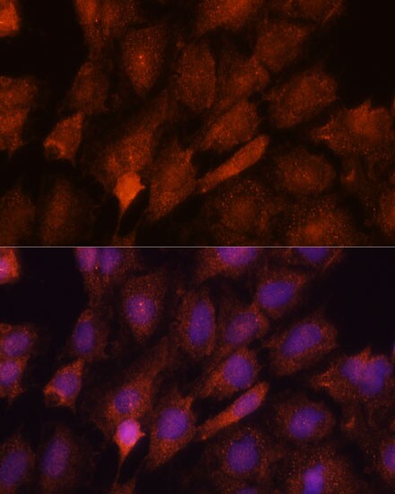 SMYD3 Antibody